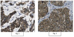 MilliporeSigma Mouse anti-Thymidylate Kinase/TMPK, Clone: 1A5.1, 100&mu;g:Antibodies,